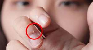 kidsonline-8 dấu hiệu bất thường trên móng tay trẻ cảnh báo bệnh nguy hiểm3