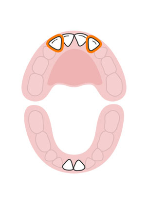 kidsonline-Tất tần tật quá trình moc răng và thay răng của trẻ4