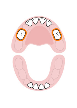kidsonline-Tất tần tật quá trình moc răng và thay răng của trẻ6