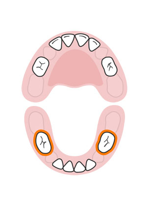 kidsonline-Tất tần tật quá trình moc răng và thay răng của trẻ7