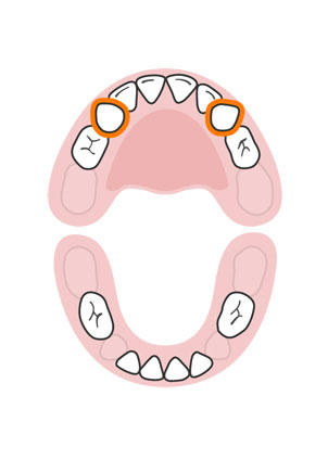 kidsonline-Tất tần tật quá trình moc răng và thay răng của trẻ8