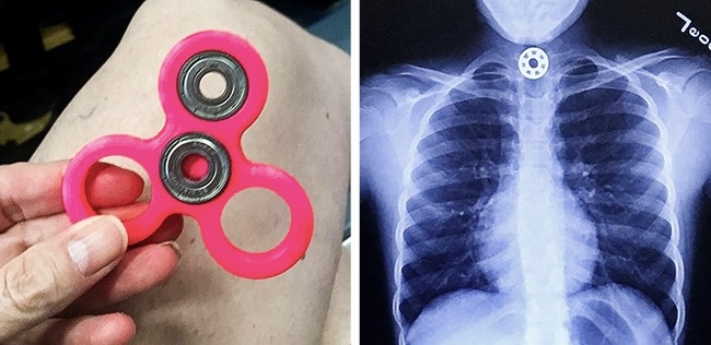 8 món đồ chơi cho trẻ em vô cùng nguy hiểm bé nào cũng có 7